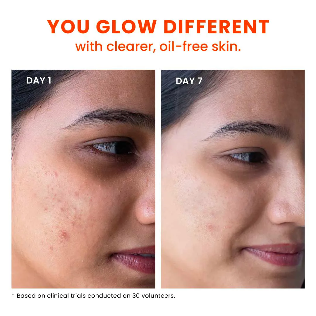 True Clarity Oil and Acne Control Face Wash - 100 ml